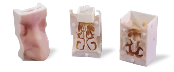 Nos do druku 3D: Przełom w medycynie rekonstrukcyjnej